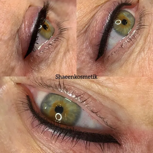 Lidstrich und Wimpernkranzverdichtung – Ergebnisse