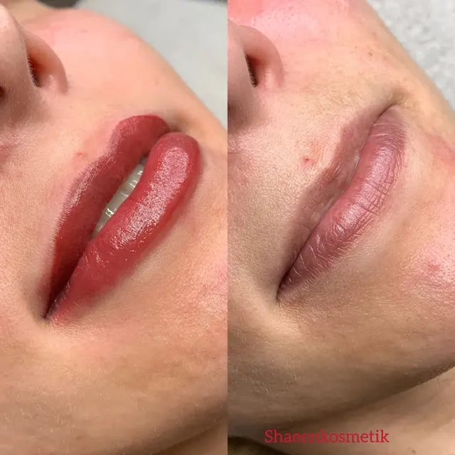 Lippen-Permanent-Make-up – direkt nach der Behandlung und abgeheilt