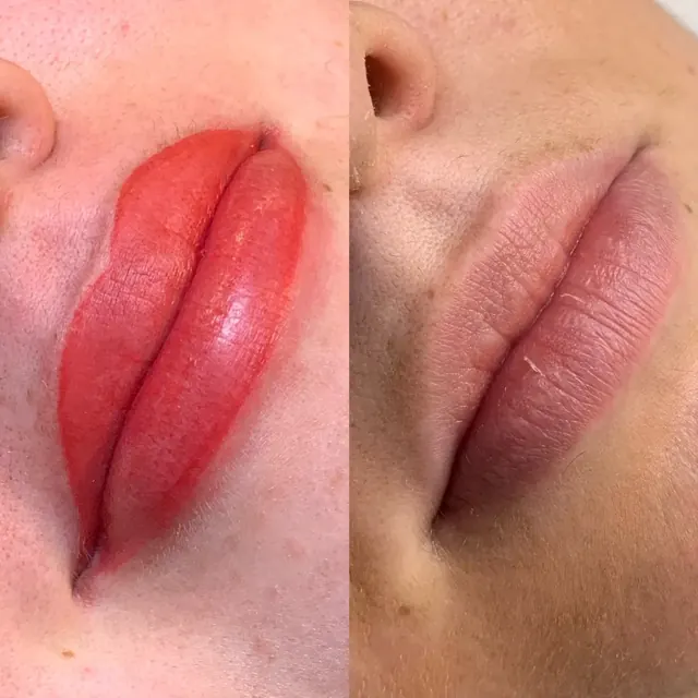 Lippen-Permanent-Make-up – direkt nach der Behandlung und abgeheilt